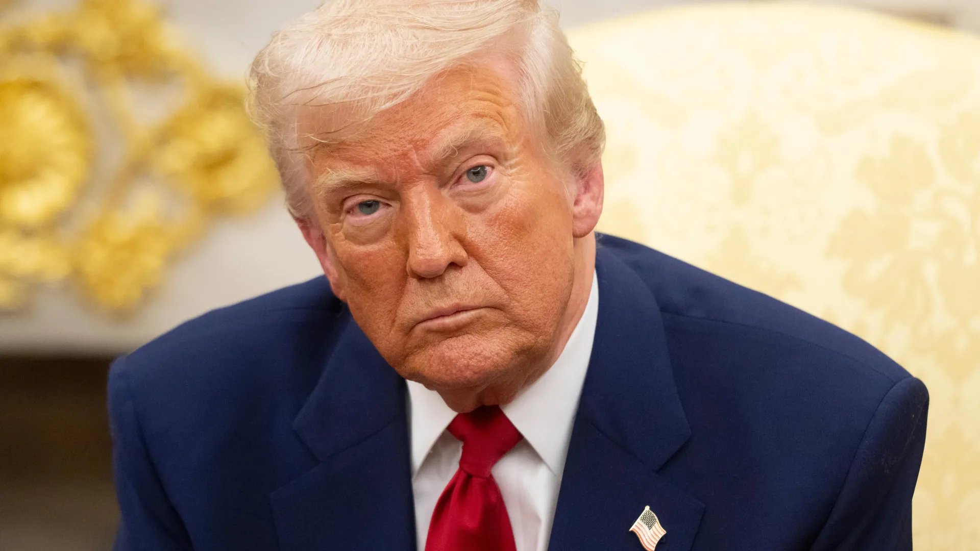 Imagem para Presidente Trump diagnosticado com Insuficiência Venosa Crônica: Conheça os riscos e tratamentos